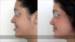 glushko-result-ortho-6.jpg