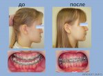 mesial2.jpg